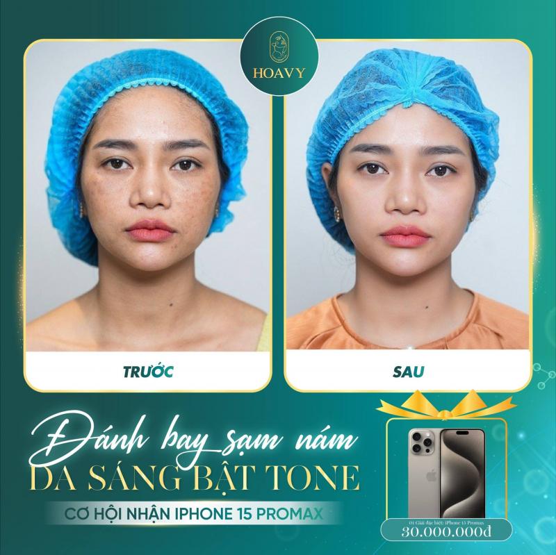 Thẩm mỹ viện Hoa Vy