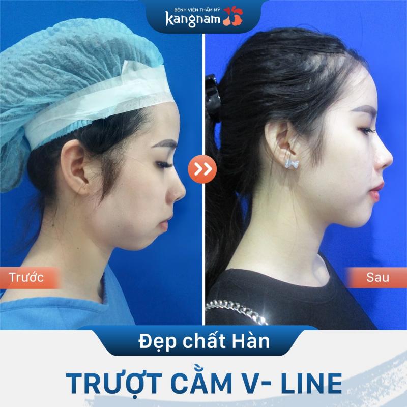 Bệnh viện thẩm mỹ Kangnam