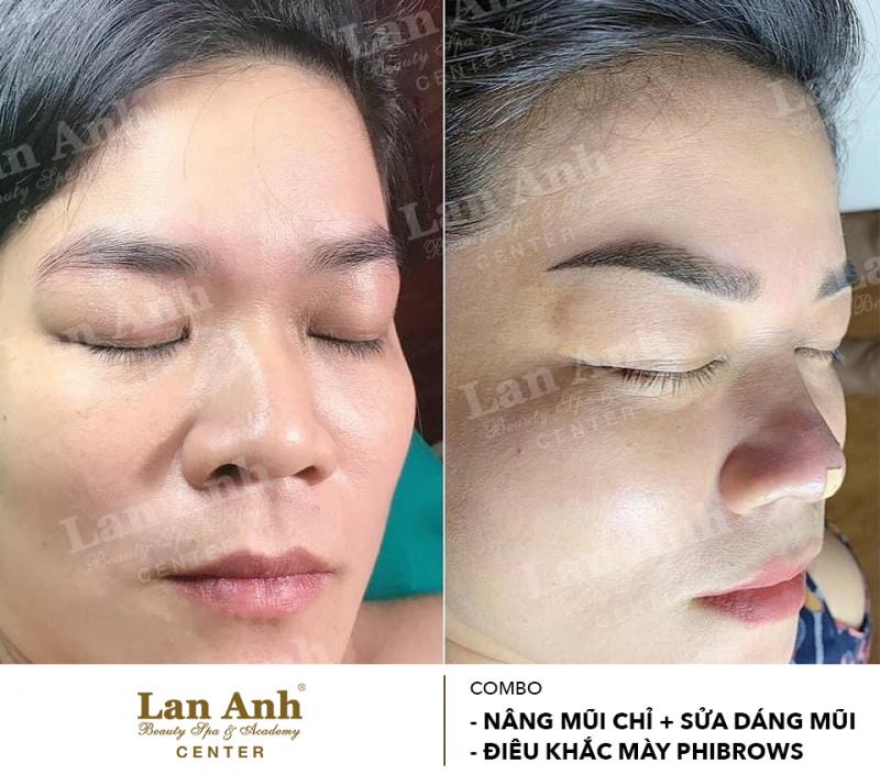 Lan Anh Beauty Center