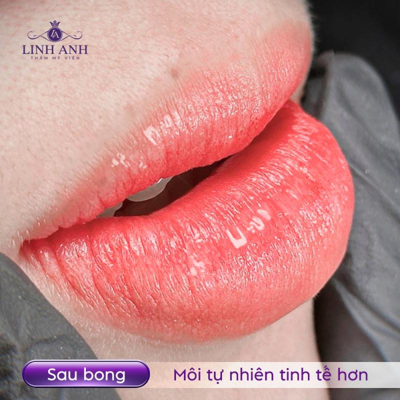 Thẩm Mỹ Quốc Tế Linh Anh - Biên Hòa