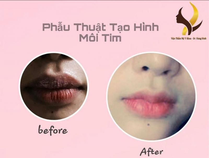 Thẩm Mỹ Viện Linh Linh Trang 9545