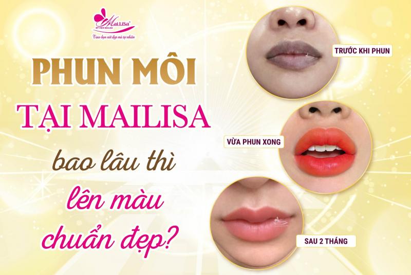 Thẩm Mỹ Viện Mailisa