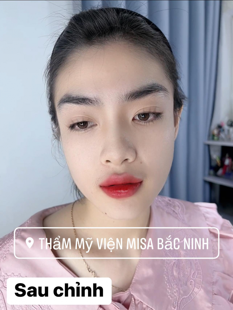 Thẩm mỹ viện MISA Bắc Ninh