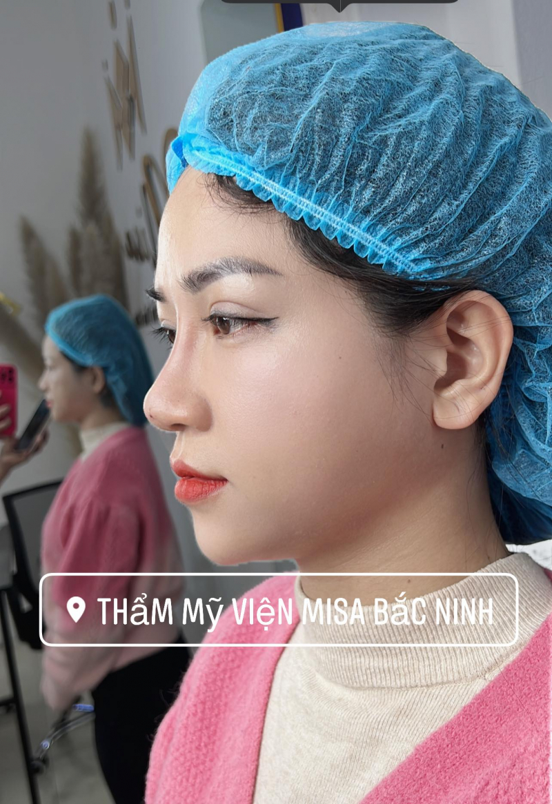 Thẩm mỹ viện MISA Bắc Ninh