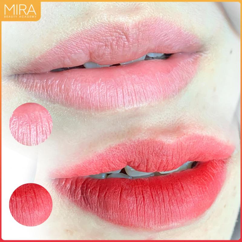 Thẩm mỹ viện MIRA