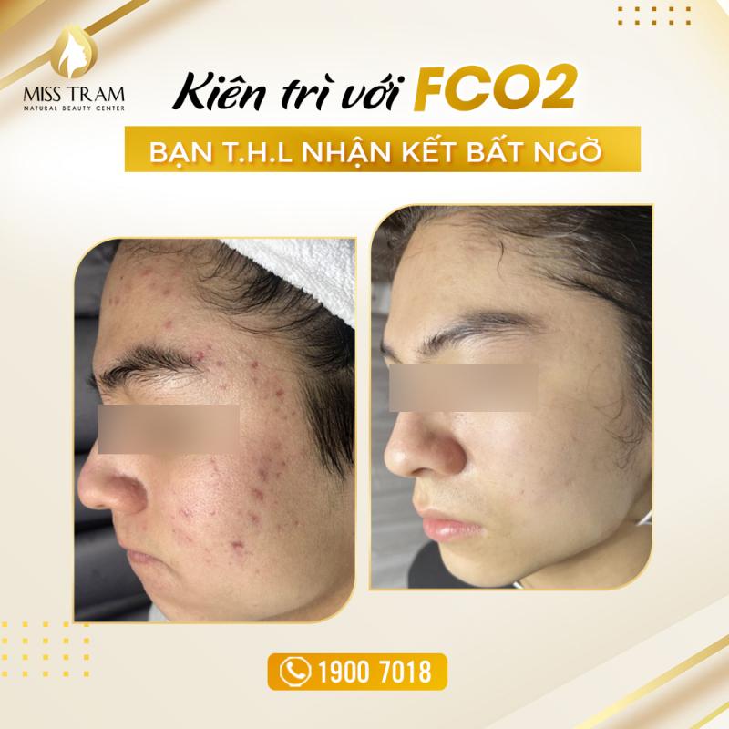 Thẩm mỹ viện Miss Trâm (Miss Tram – Natural Beauty Center)