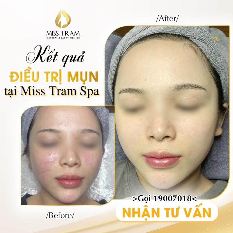 Thẩm mỹ viện Miss Trâm (Miss Tram – Natural Beauty Center)