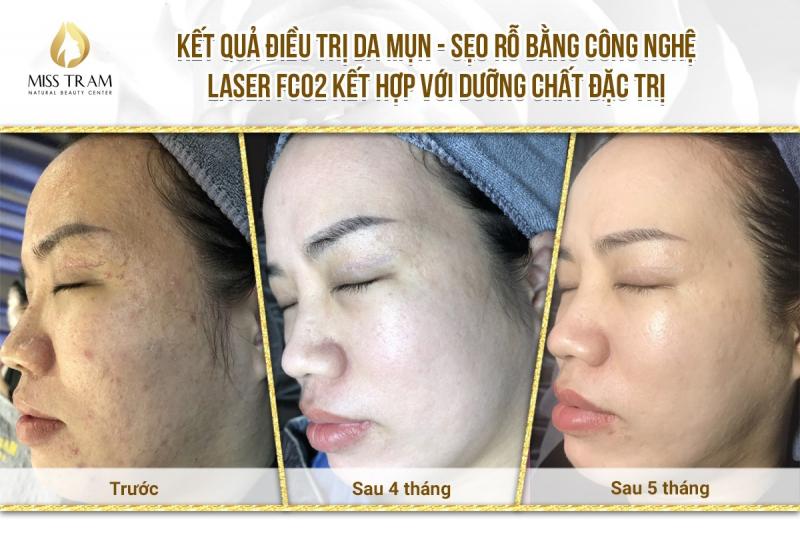 Thẩm mỹ viện Miss Trâm (Miss Tram – Natural Beauty Center)