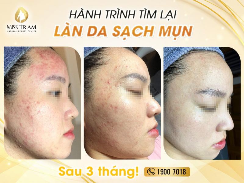 Thẩm mỹ viện Miss Trâm (Miss Tram – Natural Beauty Center)