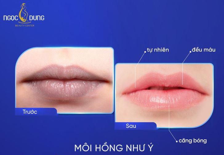 Thẩm mỹ Viện Ngọc Dung