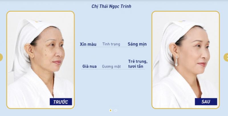 Khách hàng trị nám tại Ngọc Dung