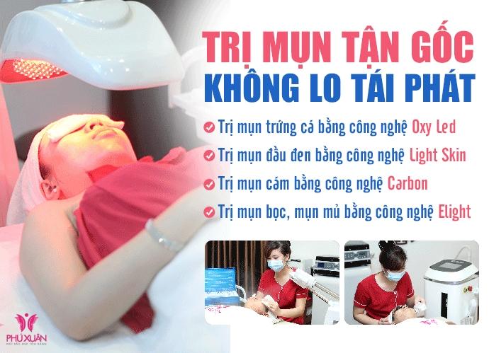 Nhưng công nghệ trị mụn tại Phú Xuân