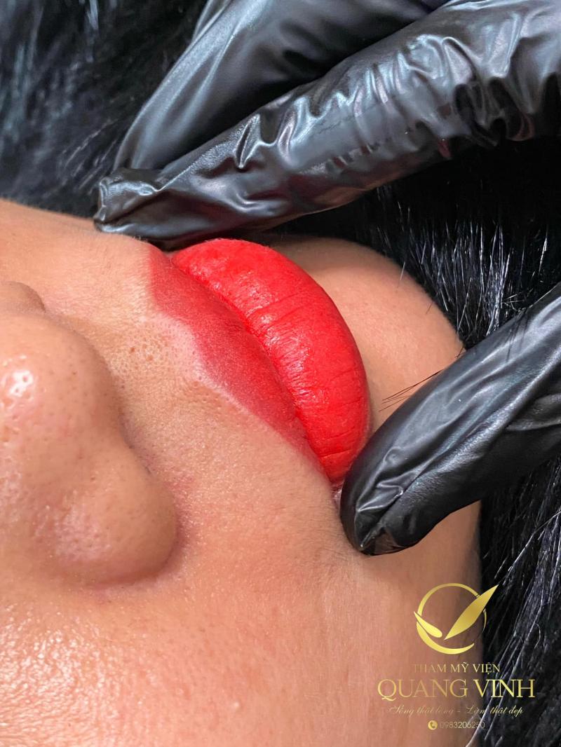 Thẩm mỹ viện Quang Vinh