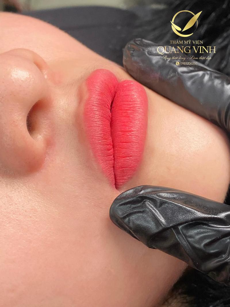 Thẩm mỹ viện Quang Vinh