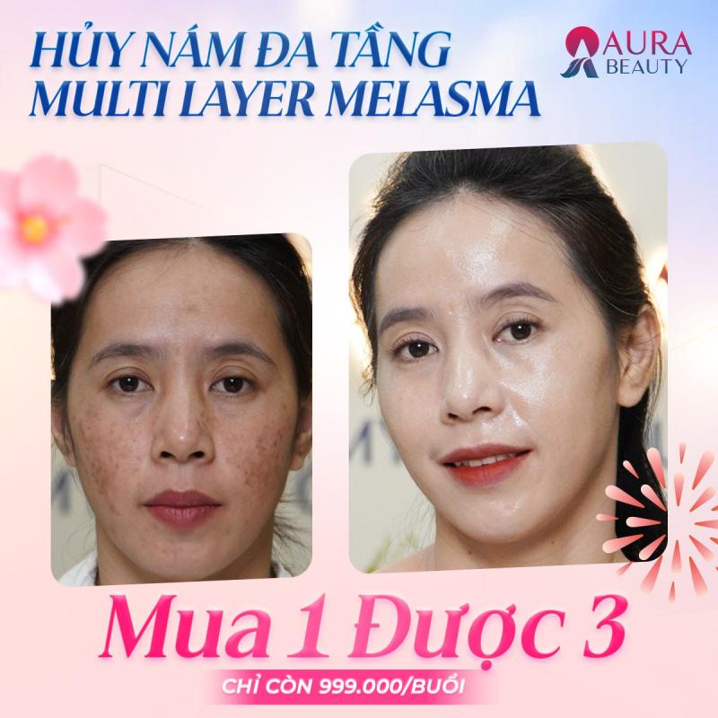 Thẩm Mỹ Viện Quốc Tế Aura Vĩnh Long