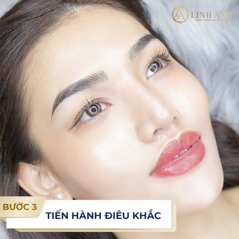 Thẩm Mỹ Viện Quốc Tế Linh Anh