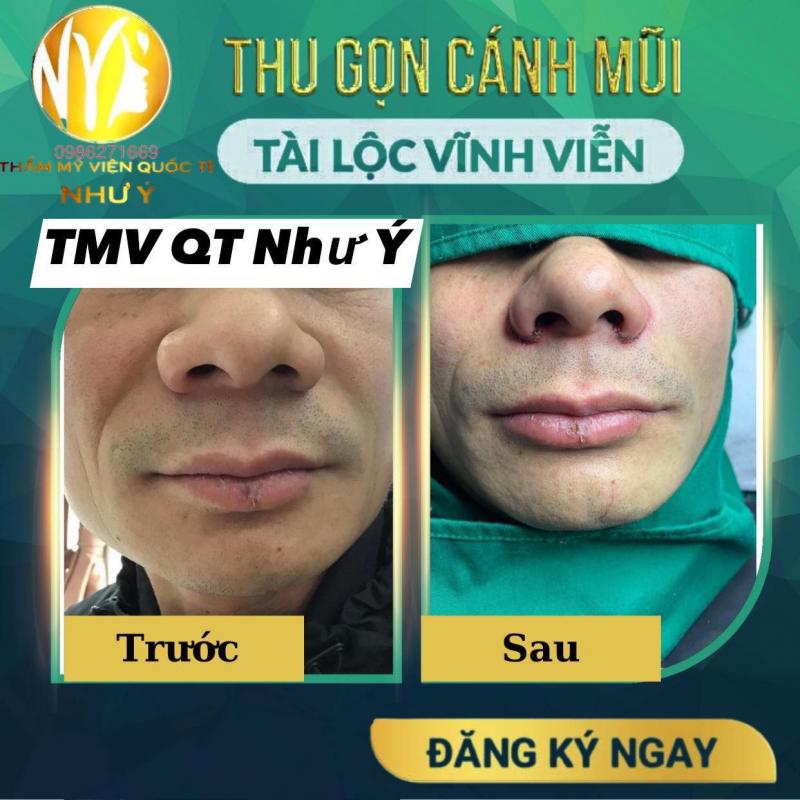 Thẩm mỹ viện Quốc tế Như Ý