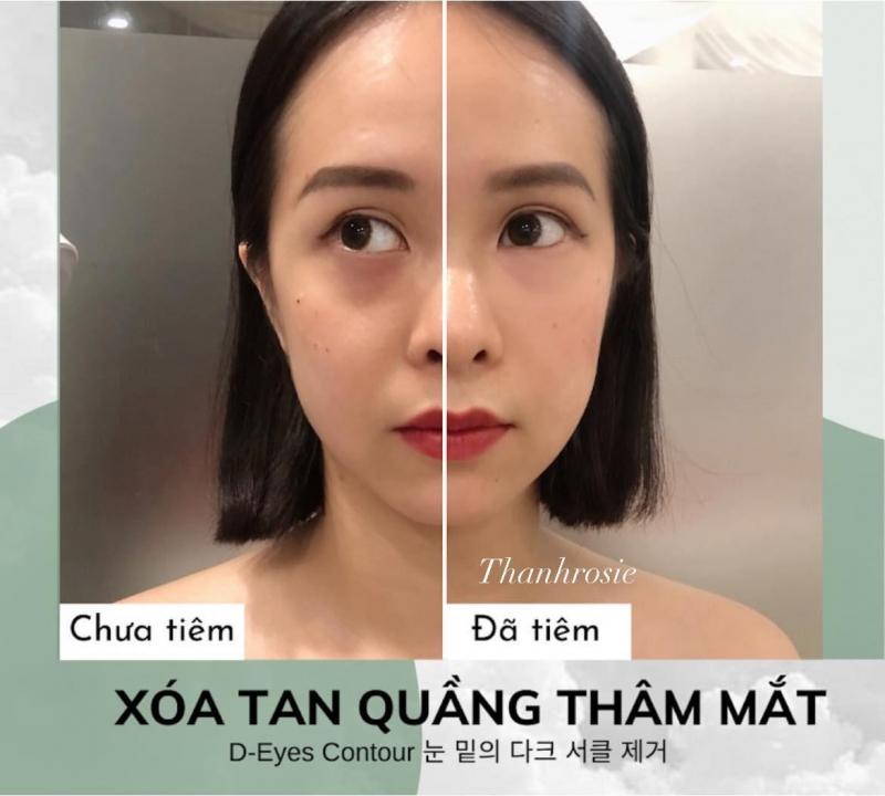 Thẩm mỹ viện Quốc tế Thanh Roise