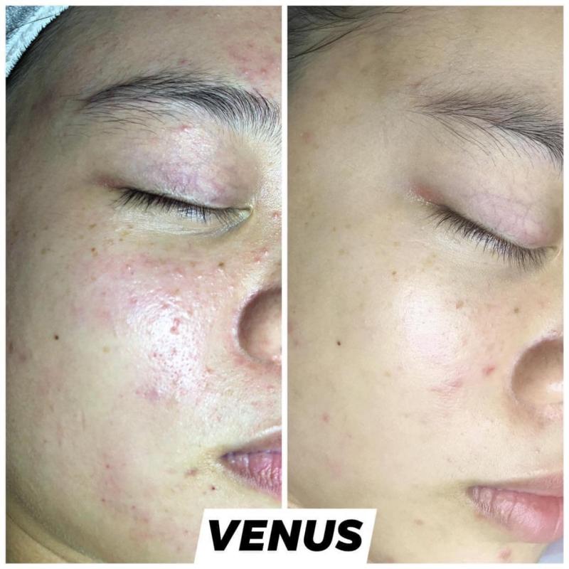 Thẩm Mỹ Viện Quốc Tế VENUS