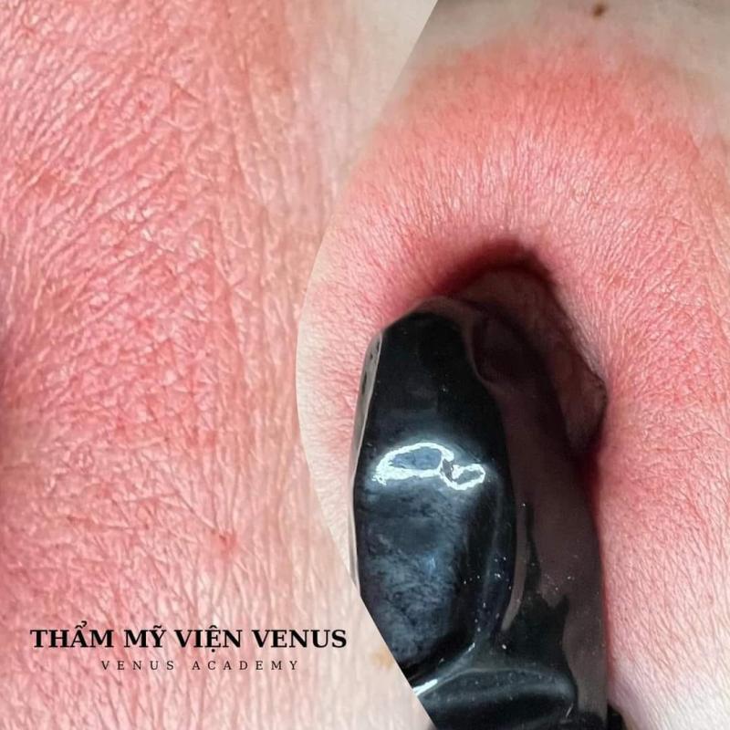 Thẩm Mỹ Viện Quốc Tế VENUS