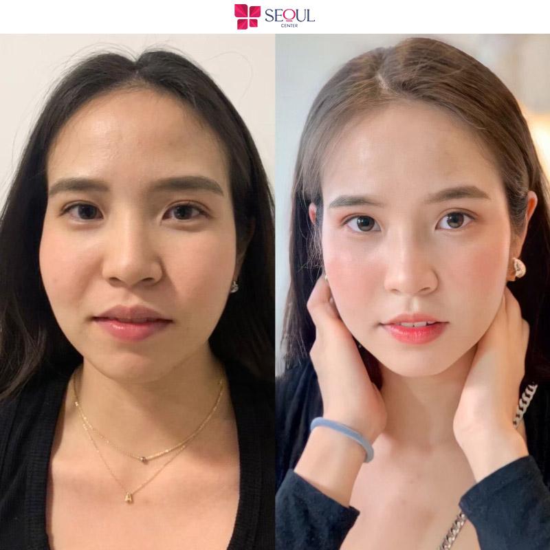 Thẩm Mỹ Viện Seoul Center