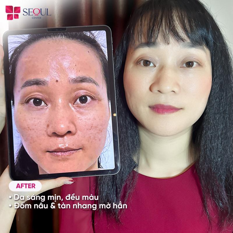 Thẩm Mỹ Viện Seoul Center