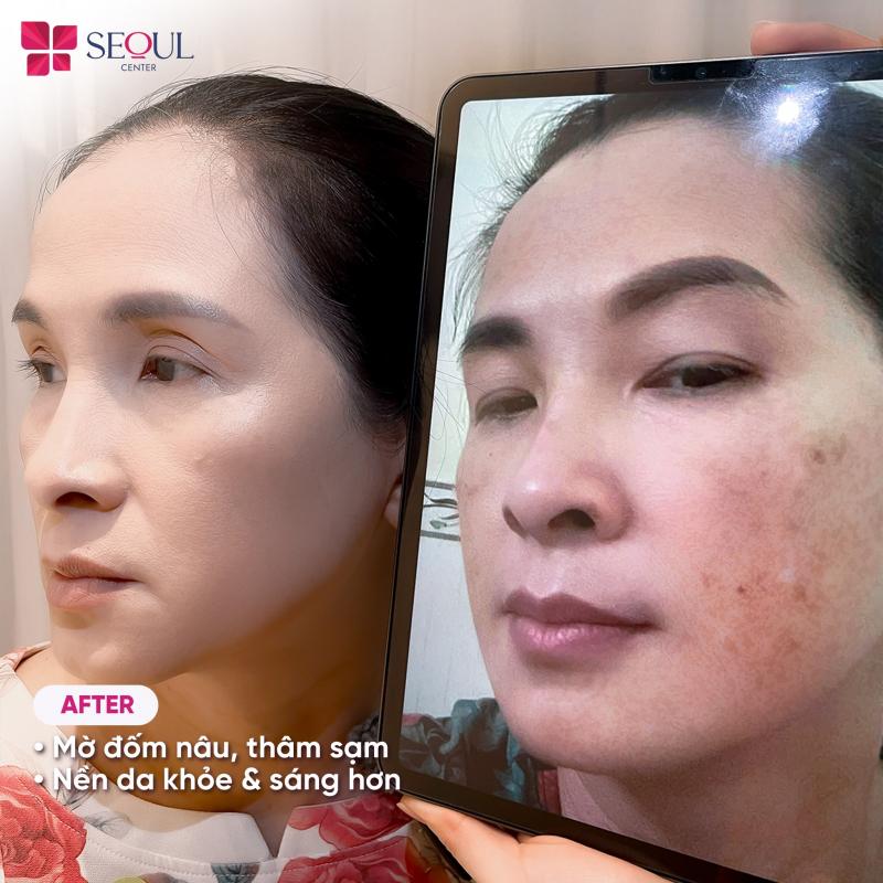 Thẩm Mỹ Viện Seoul Center