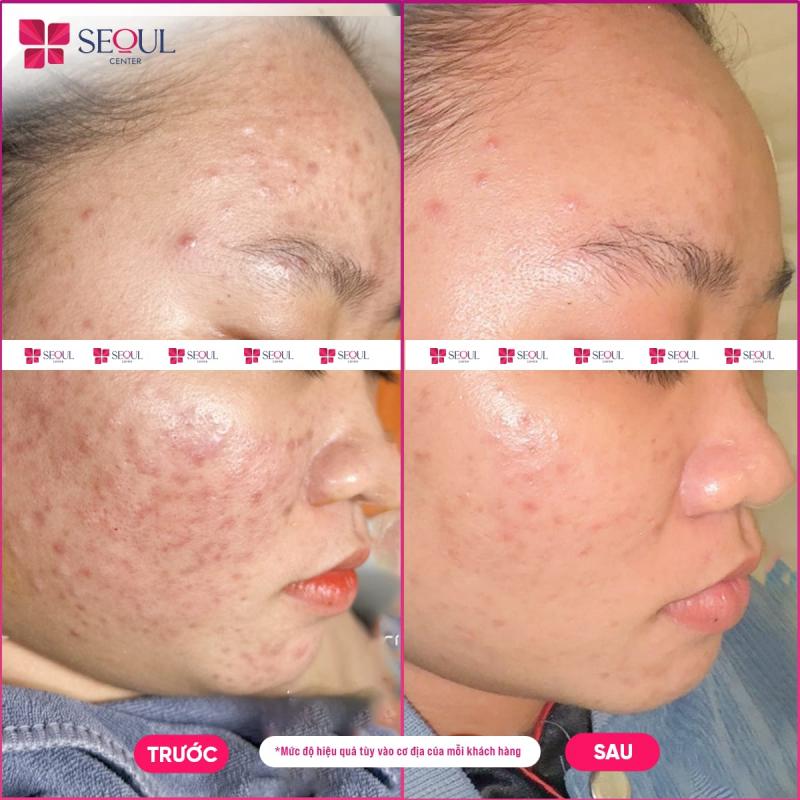 Thẩm Mỹ Viện Seoul Center Biên Hoà