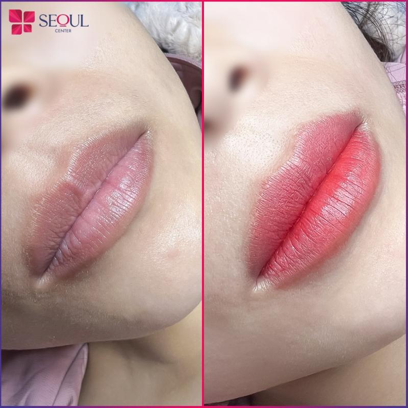 Thẩm Mỹ Viện Seoul Center Biên Hoà