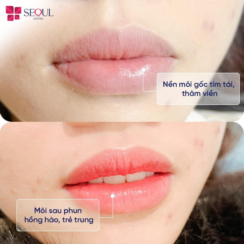 Thẩm Mỹ Viện Seoul Center Biên Hoà