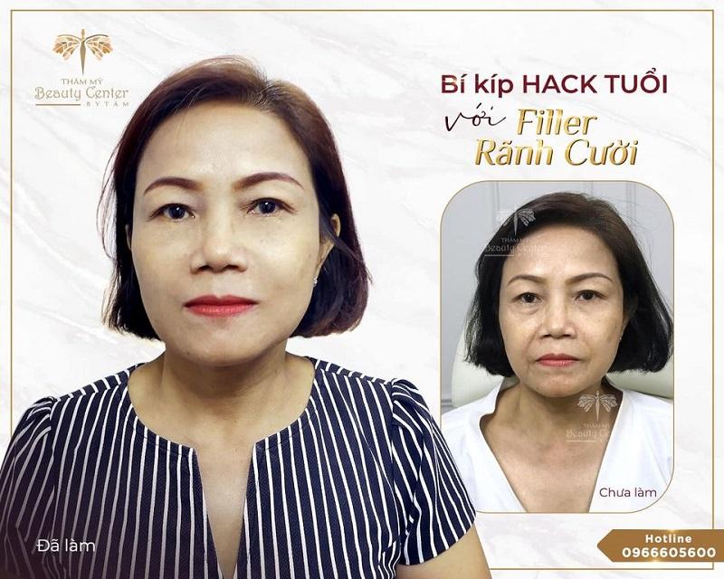 Thẩm mỹ viện Tấm