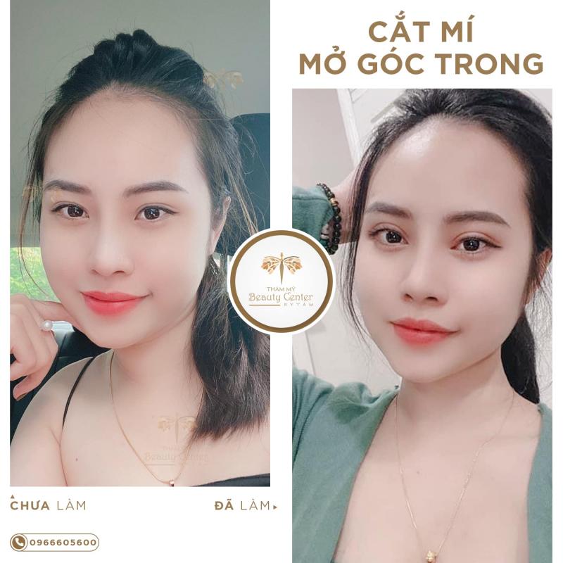 Thẩm Mỹ Beauty Center - By Tấm