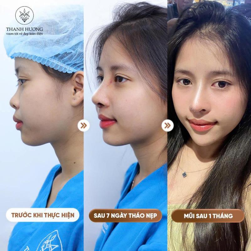 Thẩm Mỹ Viện Thanh Hương