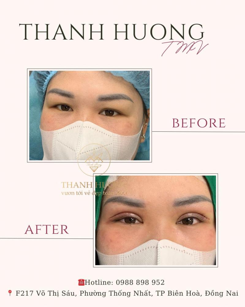 Thẩm Mỹ Viện Thanh Hương - Thẩm Mỹ Viện Được Đánh Giá Cao Tại Biên Hoà