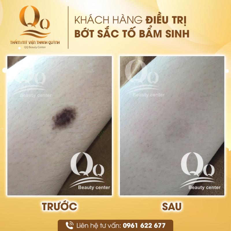 Thẩm Mỹ viện Thanh Quỳnh