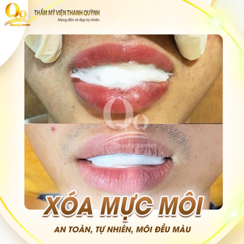 Thẩm mỹ viện Thanh Quỳnh