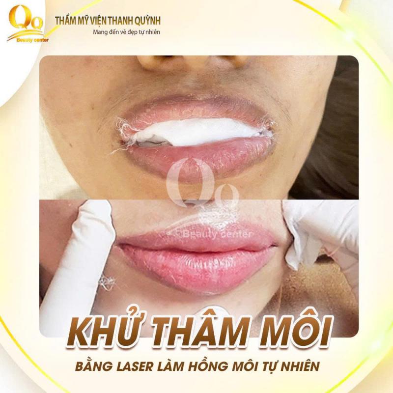 Thẩm mỹ viện Thanh Quỳnh