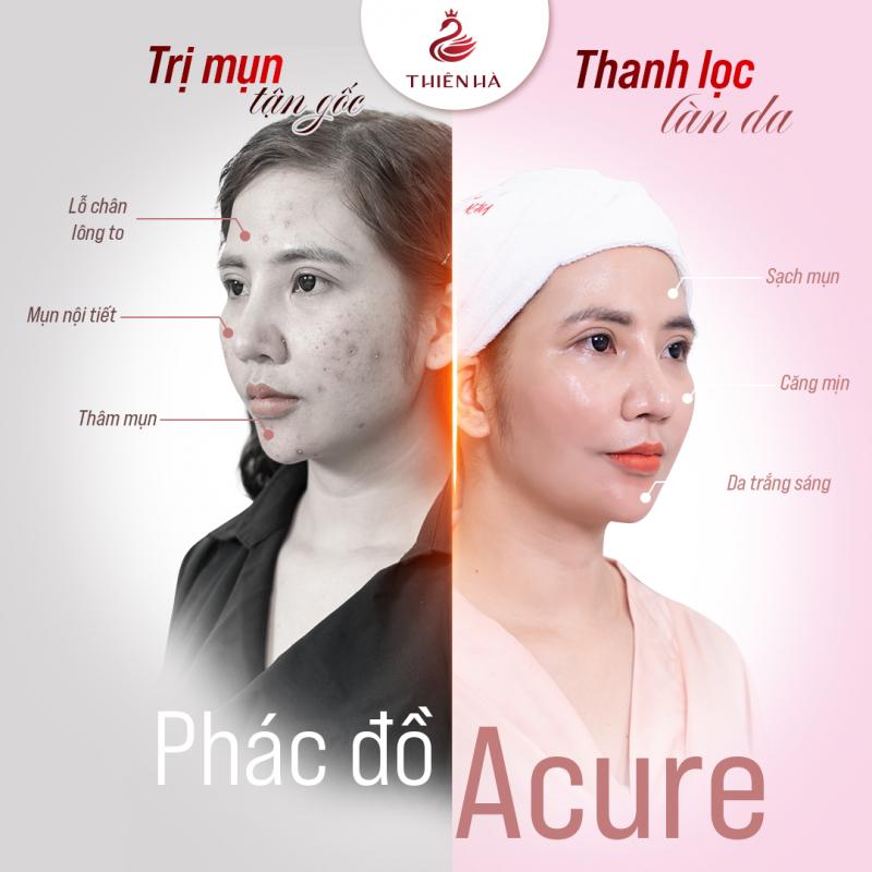 Thẩm mỹ viện Thiên Hà (Thiên Hà Spa)