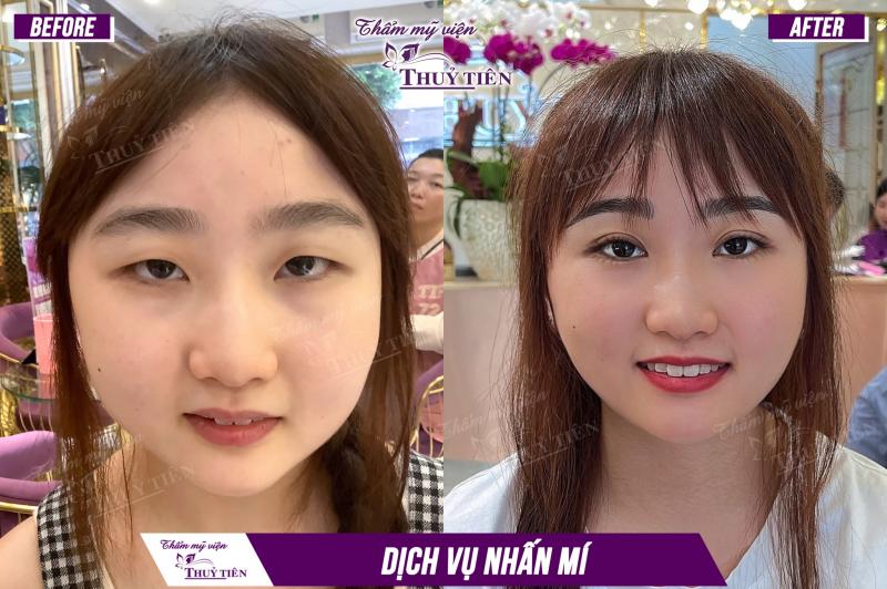 Thẩm Mỹ Viện Thủy Tiên