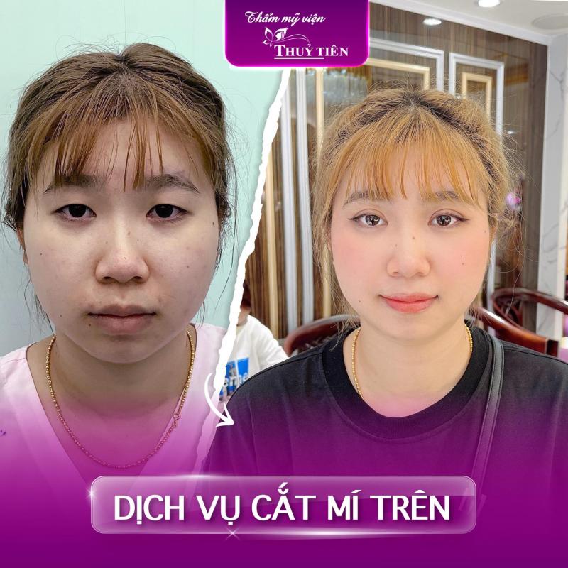 Thẩm Mỹ Viện Thủy Tiên