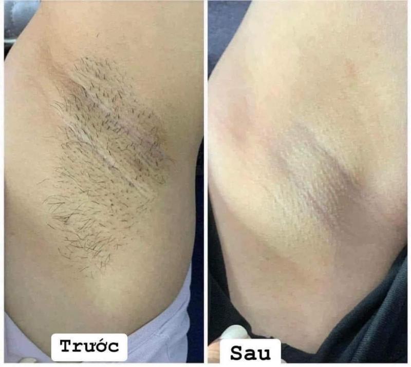 Thẩm Mỹ Viện Trần Trà