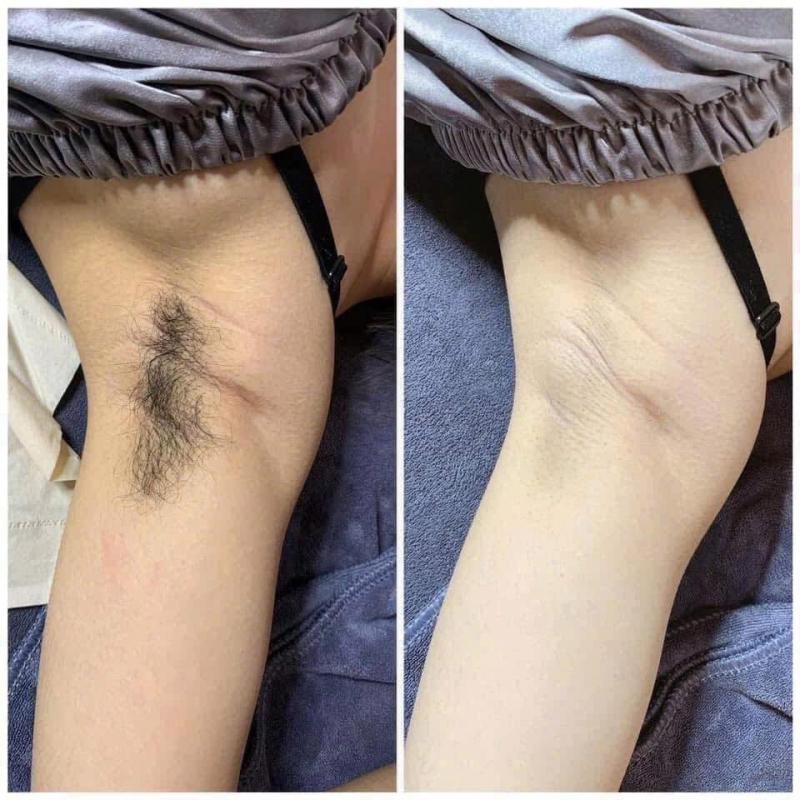 Thẩm Mỹ Viện Trần Trà