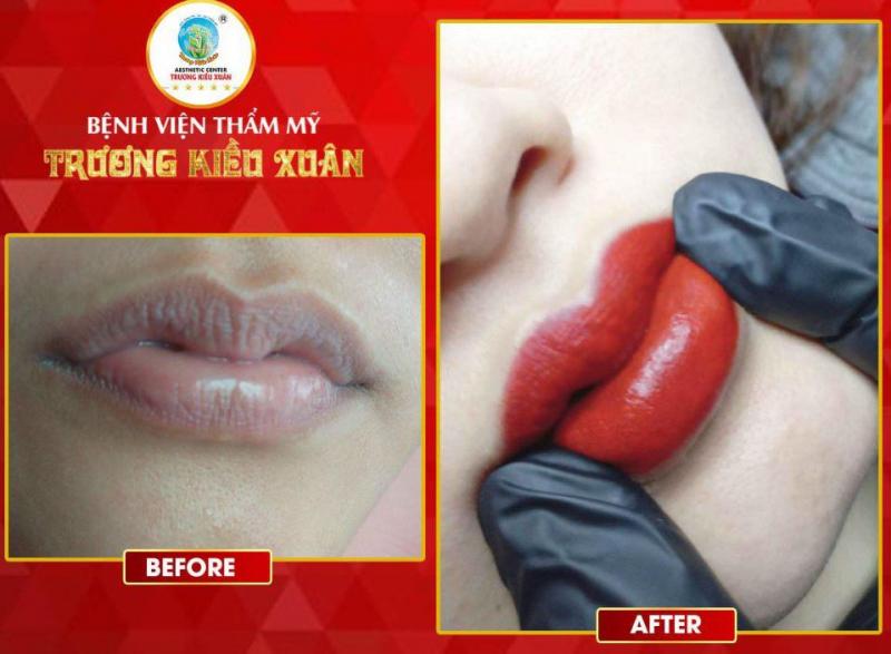 Thẩm mỹ viện Trương Kiều Xuân