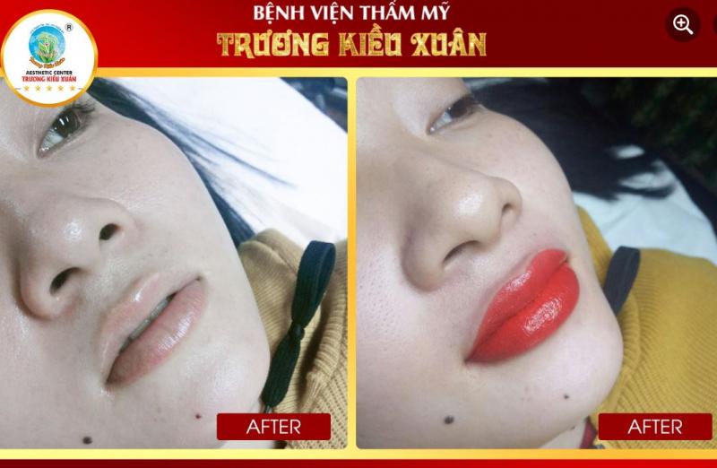 Thẩm mỹ viện Trương Kiều Xuân