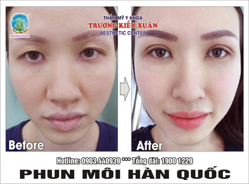 Thẩm mỹ viện y khoa Trương Kiều Xuân