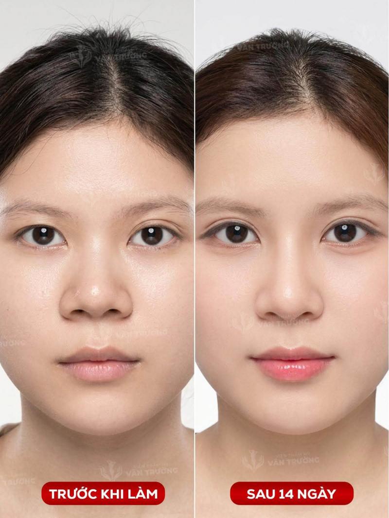 Thẩm mỹ viện Văn Trường