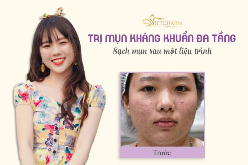 Thẩm mỹ viện Vietcharm