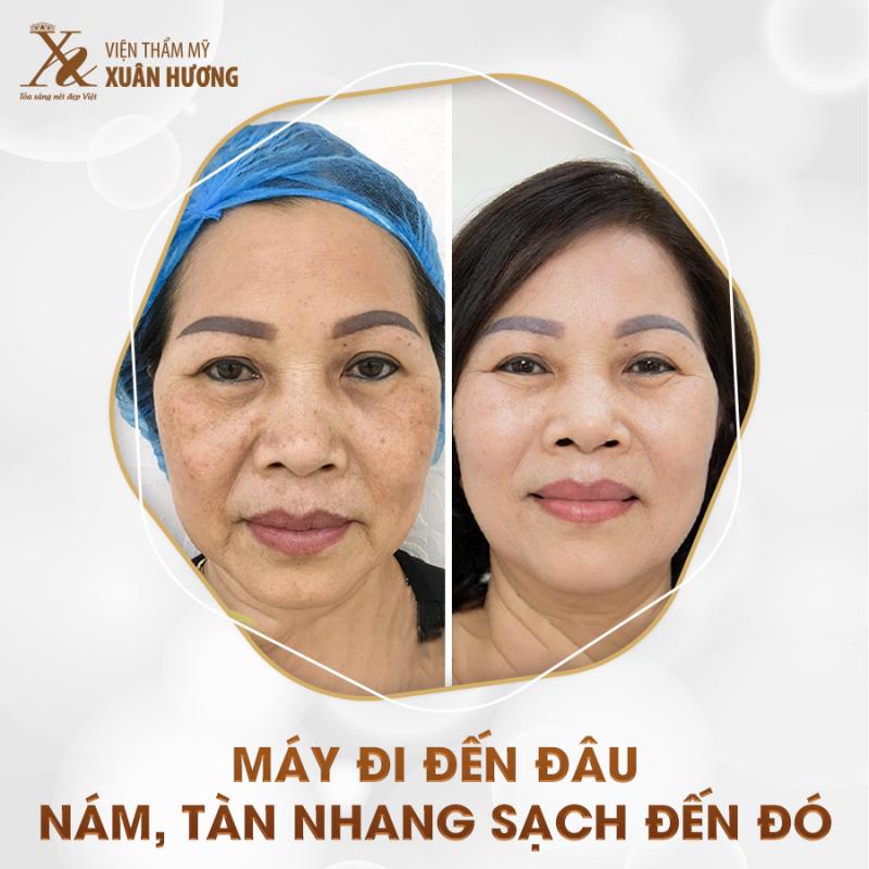 Thẩm mỹ viện Xuân Hương