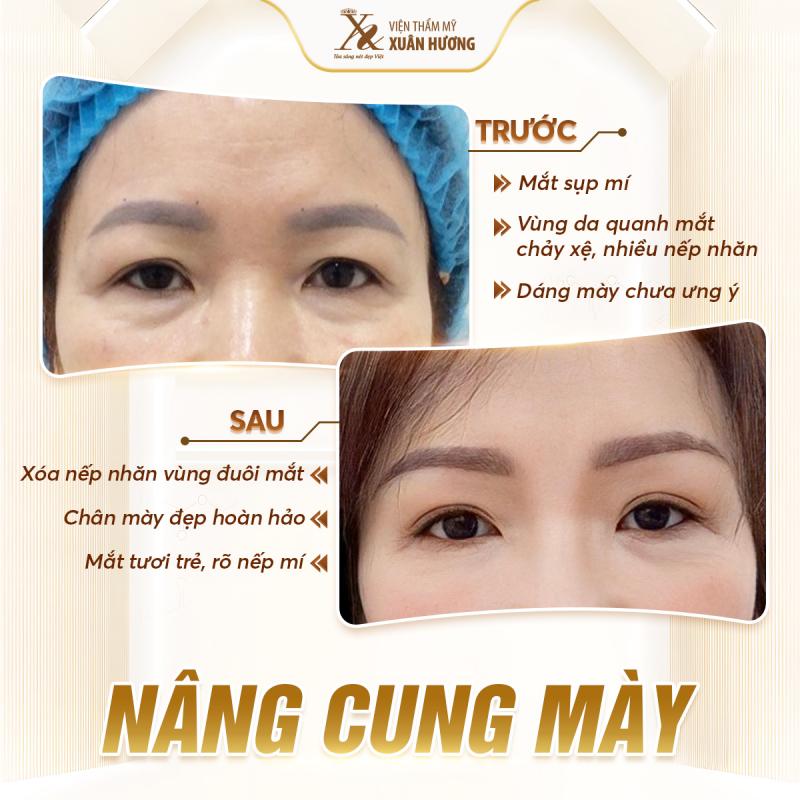 Thẩm mỹ viện Xuân Hương