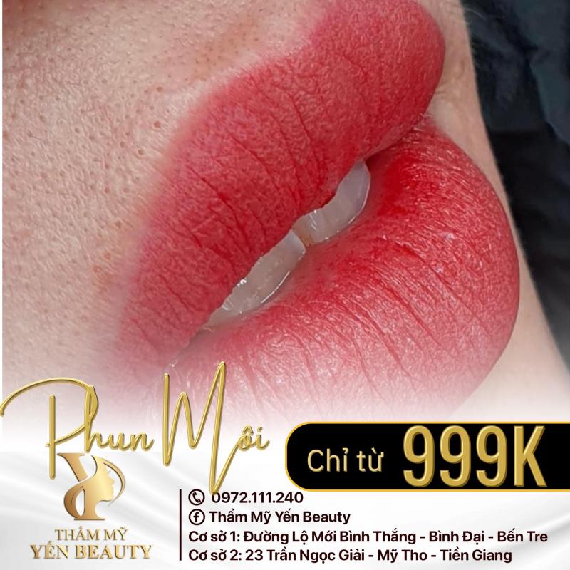 Thẩm mỹ Yến Beauty